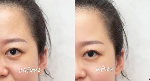 吃瓜能去眼袋吗,揭秘日常小零食的神奇功效